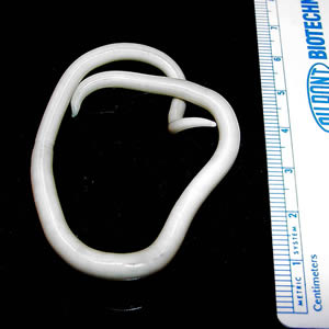 Ascaris_lumbricoides